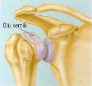 Omuz Protezi - Şenol Akman