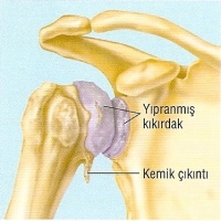 Protez Cerrahisi - Şenol Akman